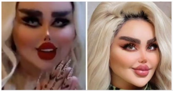 She Had 43 Cosmetic Procedures To Become A Barbie Doll – But Critics Say She Look Like A ‘Zombie’